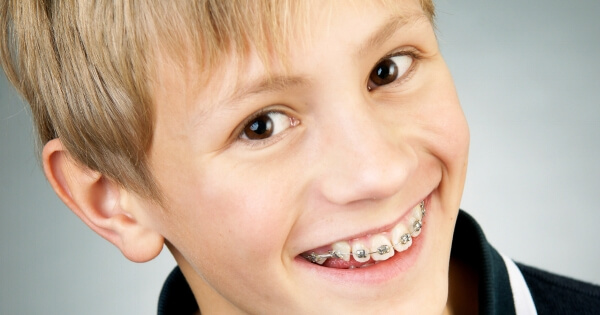 New teeth braces website Perth.